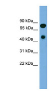 RIP4 / ANKRD3 Antibody - RIPK4 antibody Western blot of Fetal Heart lysate. This image was taken for the unconjugated form of this product. Other forms have not been tested.