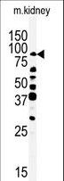 RIP4 / ANKRD3 Antibody - Western blot of anti-ANKRD3-Q817 antibody in mouse kidney tissue lysate (35 ug/lane). ANKRD3-Q817(arrow) was detected using the purified antibody.