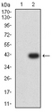 RIP4 / ANKRD3 Antibody - Western blot analysis using RIPK4 mAb against HEK293 (1) and RIPK4 (AA: 675-784)-hIgGFc transfected HEK293 (2) cell lysate.