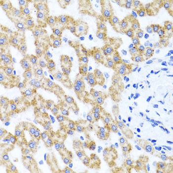 RIP4 / ANKRD3 Antibody - Immunohistochemistry of paraffin-embedded human liver injury tissue.