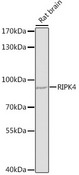 RIP4 / ANKRD3 Antibody - Western blot analysis of extracts of rat brain, using RIPK4 antibody at 1:1000 dilution. The secondary antibody used was an HRP Goat Anti-Rabbit IgG (H+L) at 1:10000 dilution. Lysates were loaded 25ug per lane and 3% nonfat dry milk in TBST was used for blocking. An ECL Kit was used for detection and the exposure time was 90s.