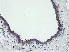 RIPK1 / RIP Antibody - IHC of paraffin-embedded Human breast tissue using anti-RIPK1 mouse monoclonal antibody.
