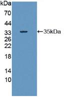 RIPK1 / RIP Antibody - Western Blot; Sample: Recombinant RIPK1, Human.