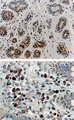 RIPK1 / RIP Antibody - IHC of RIP in formalin-fixed, paraffin-embedded tissue sections using RIPK1 / RIP Antibody at 1:2000. A, normal human breast. B, normal human colon. Plasma cells in the lamina propia of the colon are stained. Hematoxylin-Eosin counterstain.