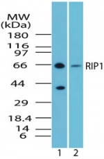 RIPK1 / RIP Antibody - Western blot of humanRIP1inramos cell lysate in the 1) absence and2) presence of immunizing peptide using antibody at2 ug/ml.
