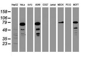 RIPK1 / RIP Antibody - Western blot of extracts (35 ug) from 9 different cell lines by using anti-RIPK1 monoclonal antibody (HepG2: human; HeLa: human; SVT2: mouse; A549: human; COS7: monkey; Jurkat: human; MDCK: canine; PC12: rat; MCF7: human).