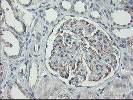 RIPK1 / RIP Antibody - IHC of paraffin-embedded Human Kidney tissue using anti-RIPK1 mouse monoclonal antibody.
