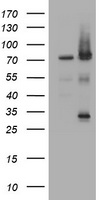 RIPK1 / RIP Antibody - HEK293T cells were transfected with the pCMV6-ENTRY control (Left lane) or pCMV6-ENTRY RIPK1 (Right lane) cDNA for 48 hrs and lysed. Equivalent amounts of cell lysates (5 ug per lane) were separated by SDS-PAGE and immunoblotted with anti-RIPK1.