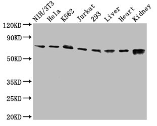 RIPK1 / RIP Antibody - Positive Western Blot detected in NIH/3T3 whole cell lysate, Hela whole cell lysate, K562 whole cell lysate, Jurkat whole cell lysate, 293 whole cell lysate, Rat liver tissue, Mouse heart tissue, Mouse kidney tissue. All lanes: RIPK1 antibody at 3.2 µg/ml Secondary Goat polyclonal to rabbit IgG at 1/50000 dilution. Predicted band size: 76, 71 KDa. Observed band size: 76 KDa