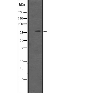 RIPK1 / RIP Antibody - Western blot analysis of RIPK1 expression in rat kidney tissue lysate. The lane on the left is treated with the antigen-specific peptide.