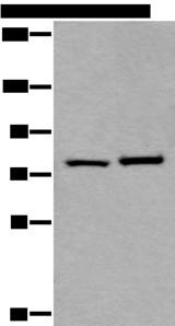 RIPK1 / RIP Antibody - Western blot analysis of Hela and HEPG2 cell lysates  using RIPK1 Polyclonal Antibody at dilution of 1:800