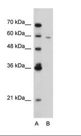 RIPK3 / RIP3 Antibody - Jurkat Cell Lysate.  This image was taken for the unconjugated form of this product. Other forms have not been tested.