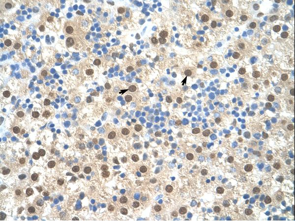 RIPK3 / RIP3 Antibody - RIPK3 / RIP3 antibody ARP31513_T100-NP_006862-RIPK3(receptor-interacting serine-threonine kinase 3) Antibody was used in IHC to stain formalin-fixed, paraffin-embedded human liver.  This image was taken for the unconjugated form of this product. Other forms have not been tested.