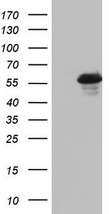 RIPK3 / RIP3 Antibody - HEK293T cells were transfected with the pCMV6-ENTRY control (Left lane) or pCMV6-ENTRY RIPK3 (Right lane) cDNA for 48 hrs and lysed. Equivalent amounts of cell lysates (5 ug per lane) were separated by SDS-PAGE and immunoblotted with anti-RIPK3.