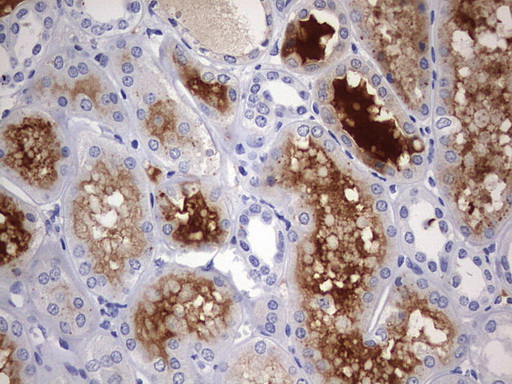 RIPK3 / RIP3 Antibody - IHC of paraffin-embedded Human Kidney tissue using anti-RIPK3 mouse monoclonal antibody. (Heat-induced epitope retrieval by 1 mM EDTA in 10mM Tris, pH9.0, 120°C for 3min).