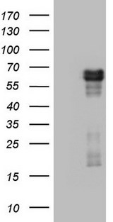 RIPK3 / RIP3 Antibody - HEK293T cells were transfected with the pCMV6-ENTRY control (Left lane) or pCMV6-ENTRY RIPK3 (Right lane) cDNA for 48 hrs and lysed. Equivalent amounts of cell lysates (5 ug per lane) were separated by SDS-PAGE and immunoblotted with anti-RIPK3.