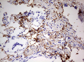 RIPK3 / RIP3 Antibody - IHC of paraffin-embedded Human Ovary tissue using anti-RIPK3 mouse monoclonal antibody. (Heat-induced epitope retrieval by 10mM citric buffer, pH6.0, 120°C for 3min).