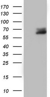 RIPK3 / RIP3 Antibody - HEK293T cells were transfected with the pCMV6-ENTRY control (Left lane) or pCMV6-ENTRY RIPK3 (Right lane) cDNA for 48 hrs and lysed. Equivalent amounts of cell lysates (5 ug per lane) were separated by SDS-PAGE and immunoblotted with anti-RIPK3.