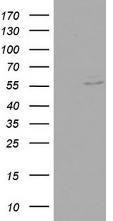 RIPK3 / RIP3 Antibody - HEK293T cells were transfected with the pCMV6-ENTRY control (Left lane) or pCMV6-ENTRY RIPK3 (Right lane) cDNA for 48 hrs and lysed. Equivalent amounts of cell lysates (5 ug per lane) were separated by SDS-PAGE and immunoblotted with anti-RIPK3.