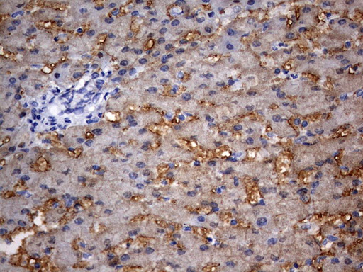 RIPK3 / RIP3 Antibody - IHC of paraffin-embedded Human liver tissue using anti-RIPK3 mouse monoclonal antibody. (Heat-induced epitope retrieval by 10mM citric buffer, pH6.0, 120°C for 3min).