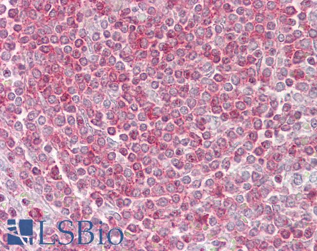 RIPK3 / RIP3 Antibody - Anti-RIPK3 / RIP3 antibody IHC of human spleen. Immunohistochemistry of formalin-fixed, paraffin-embedded tissue after heat-induced antigen retrieval. Antibody concentration 5 ug/ml.  This image was taken for the unconjugated form of this product. Other forms have not been tested.