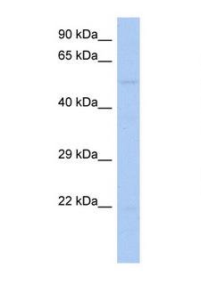 RIPK3 / RIP3 Antibody - RIPK3 / RIP3 antibody Western blot of PANC1 Cell lysate. Antibody concentration 1 ug/ml. This image was taken for the unconjugated form of this product. Other forms have not been tested.