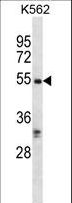 RIPK3 / RIP3 Antibody - RIPK3 Antibody western blot of K562 cell line lysates (35 ug/lane). The RIPK3 antibody detected the RIPK3 protein (arrow).