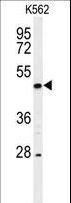 RIPK3 / RIP3 Antibody - Western blot of hRIPK3-E504 in K562 cell line lysates (35 ug/lane). RIPK3 (arrow) was detected using the purified antibody.