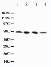 RIPK3 / RIP3 Antibody - WB of RIPK3 / RIP3 antibody. Lane 1: PANC Cell Lysate. Lane 2: SW620 Cell Lysate. Lane 3: SKOV-3 Cell Lysate. Lane 4: M231 Cell Lysate.