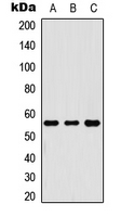 RIPK3 / RIP3 Antibody - Western blot analysis of RIPK3 expression in A549 (A); Raw264.7 (B); PC12 (C) whole cell lysates.