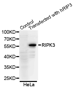 RIPK3 / RIP3 Antibody - Western blot analysis of HeLa cells.