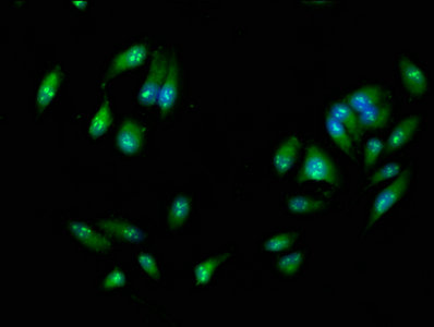 RIPK3 / RIP3 Antibody - Immunofluorescence staining of Hela cells with RIPK3 Antibody at 1:266, counter-stained with DAPI. The cells were fixed in 4% formaldehyde, permeabilized using 0.2% Triton X-100 and blocked in 10% normal Goat Serum. The cells were then incubated with the antibody overnight at 4°C. The secondary antibody was Alexa Fluor 488-congugated AffiniPure Goat Anti-Rabbit IgG(H+L).