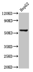 RIPK3 / RIP3 Antibody - Western Blot Positive WB detected in: HepG2 whole cell lysate All lanes: RIPK3 antibody at 3µg/ml Secondary Goat polyclonal to rabbit IgG at 1/50000 dilution Predicted band size: 57, 28, 26 kDa Observed band size: 57 kDa