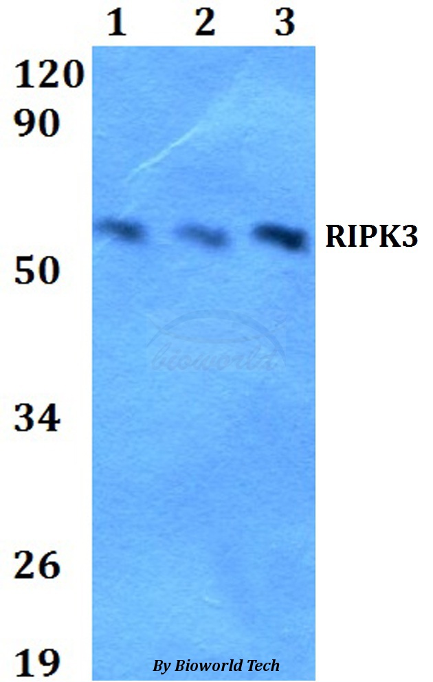 RIPK3 / RIP3 Antibody - Western blot of RIPK3 antibody at 1:500 dilution. Lane 1: A549 whole cell lysate. Lane 2: Raw264.7 whole cell lysate. Lane 3: PC12 whole cell lysate.