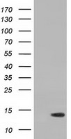 RIPPLY2 Antibody - HEK293T cells were transfected with the pCMV6-ENTRY control (Left lane) or pCMV6-ENTRY RIPPLY2 (Right lane) cDNA for 48 hrs and lysed. Equivalent amounts of cell lysates (5 ug per lane) were separated by SDS-PAGE and immunoblotted with anti-RIPPLY2.