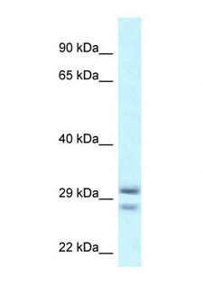 RIT1 Antibody - RIT1 antibody Western blot of 1 Cell lysate. Antibody concentration 1 ug/ml.  This image was taken for the unconjugated form of this product. Other forms have not been tested.