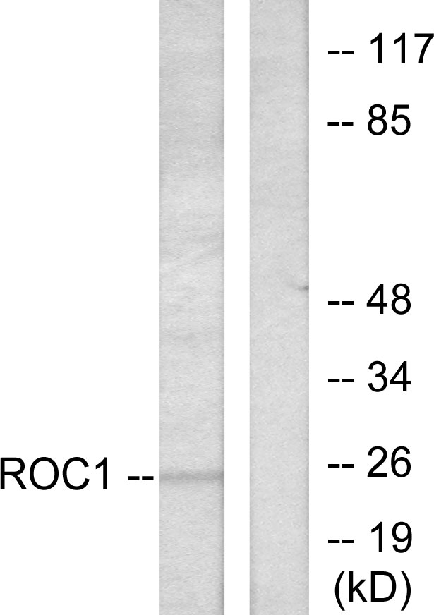 RIT1 Antibody - Western blot analysis of lysates from Jurkat cells, using RIT1 Antibody. The lane on the right is blocked with the synthesized peptide.