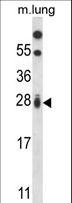 RIT1 Antibody - RIT1 Antibody western blot of mouse lung tissue lysates (35 ug/lane). The RIT1 antibody detected the RIT1 protein (arrow).