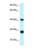 RIT1 Antibody - RIT1 antibody Western blot of ACHN Cell lysate. Antibody concentration 1 ug/ml.  This image was taken for the unconjugated form of this product. Other forms have not been tested.