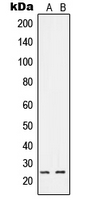 RIT1 Antibody - Western blot analysis of RIT1 expression in A549 (A); HeLa (B) whole cell lysates.