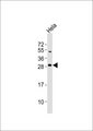 RIT1 Antibody - Anti-RIT1 Antibody at 1:1000 dilution + HeLa whole cell lysates Lysates/proteins at 20 ug per lane. Secondary Goat Anti-Rabbit IgG, (H+L),Peroxidase conjugated at 1/10000 dilution Predicted band size : 25 kDa Blocking/Dilution buffer: 5% NFDM/TBST.