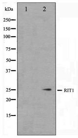 RIT1 Antibody - Western blot of Jurkat cell lysate using RIT1 Antibody