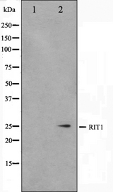 RIT1 Antibody - Western blot analysis on Jurkat cell lysates using RIT1 antibody. The lane on the left is treated with the antigen-specific peptide.