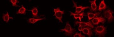 RIT1 Antibody - Staining HeLa cells by IF/ICC. The samples were fixed with PFA and permeabilized in 0.1% Triton X-100, then blocked in 10% serum for 45 min at 25°C. The primary antibody was diluted at 1:200 and incubated with the sample for 1 hour at 37°C. An Alexa Fluor 594 conjugated goat anti-rabbit IgG (H+L) Ab, diluted at 1/600, was used as the secondary antibody.