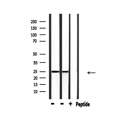RIT1 Antibody - Western blot analysis of extracts of mouse lung, rat brain tissue using RIT1 antibody.