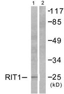 RIT1 Antibody - Western blot analysis of extracts from Jurkat cells, using RIT1 antibody.