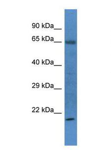 RIT1 Antibody - Western blot of Rat Heart. Rit1 antibody dilution 1.0 ug/ml.  This image was taken for the unconjugated form of this product. Other forms have not been tested.
