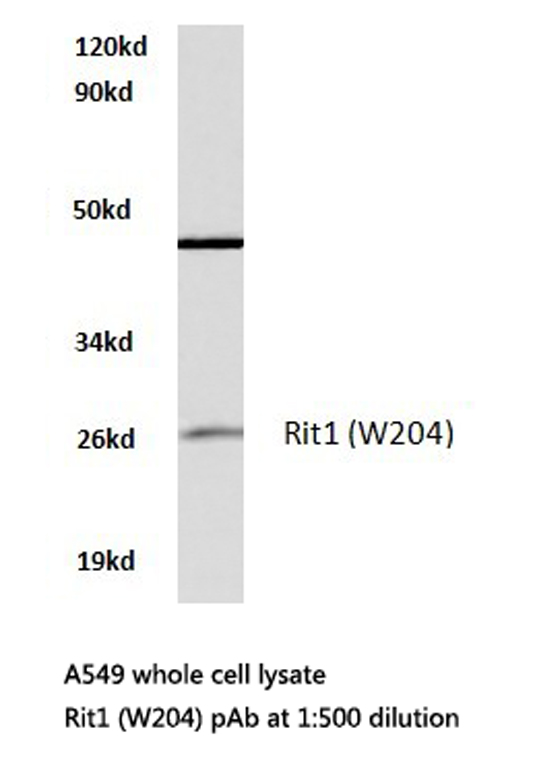 RIT1 Antibody - Western blot of ROC1 (W204) pAb in extracts from A549 cells.