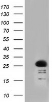 RIT2 / RIN Antibody - HEK293T cells were transfected with the pCMV6-ENTRY control (Left lane) or pCMV6-ENTRY RIT2 (Right lane) cDNA for 48 hrs and lysed. Equivalent amounts of cell lysates (5 ug per lane) were separated by SDS-PAGE and immunoblotted with anti-RIT2.