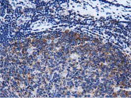 RIT2 / RIN Antibody - Immunohistochemical staining of paraffin-embedded Human lymph node tissue using anti-RIT2 mouse monoclonal antibody. (Dilution 1:50).
